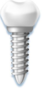 Recommended Dentures in Shenzhen