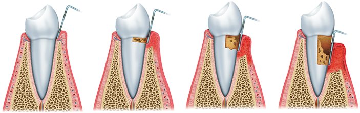 Recommended Shenzhen periodontal treatment clinic