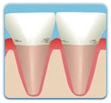 Shenzhen gingivitis treatment specialist