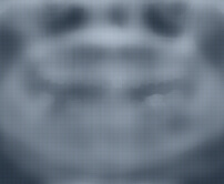 Hong Kong root canal specialists