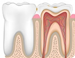Shenzhen pulpitis treatment