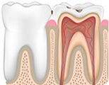 Shenzhen root canal treatment