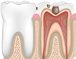 Shenzhen root canal specialist