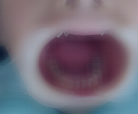 Best root canal clinic in Shenzhen