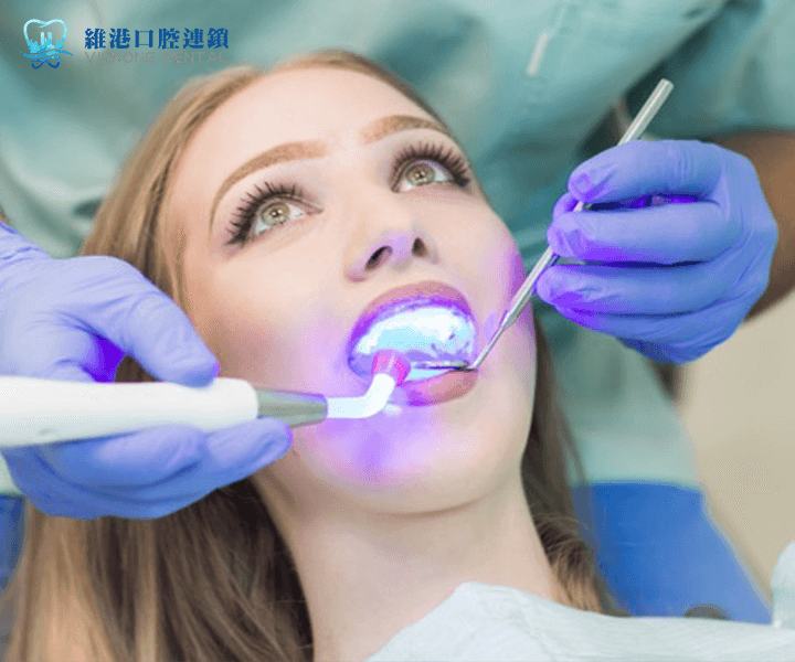 Shenzhen veneers cost