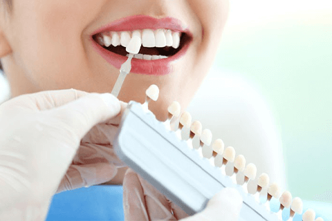 Shenzhen veneers face intro
