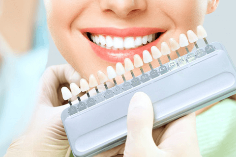 Shenzhen veneers cost