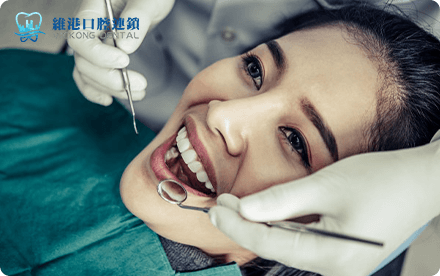 Shenzhen veneers best choice