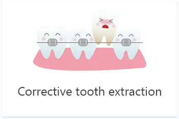 Shenzhen Tooth Extraction Fee