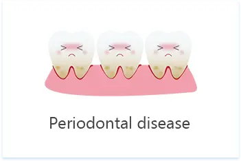 Hong Kong Tooth Extraction Price